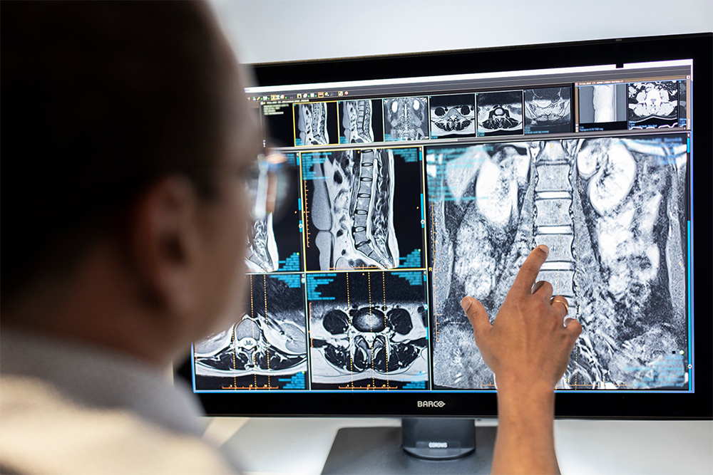 Radiologist looking at scans of the spine