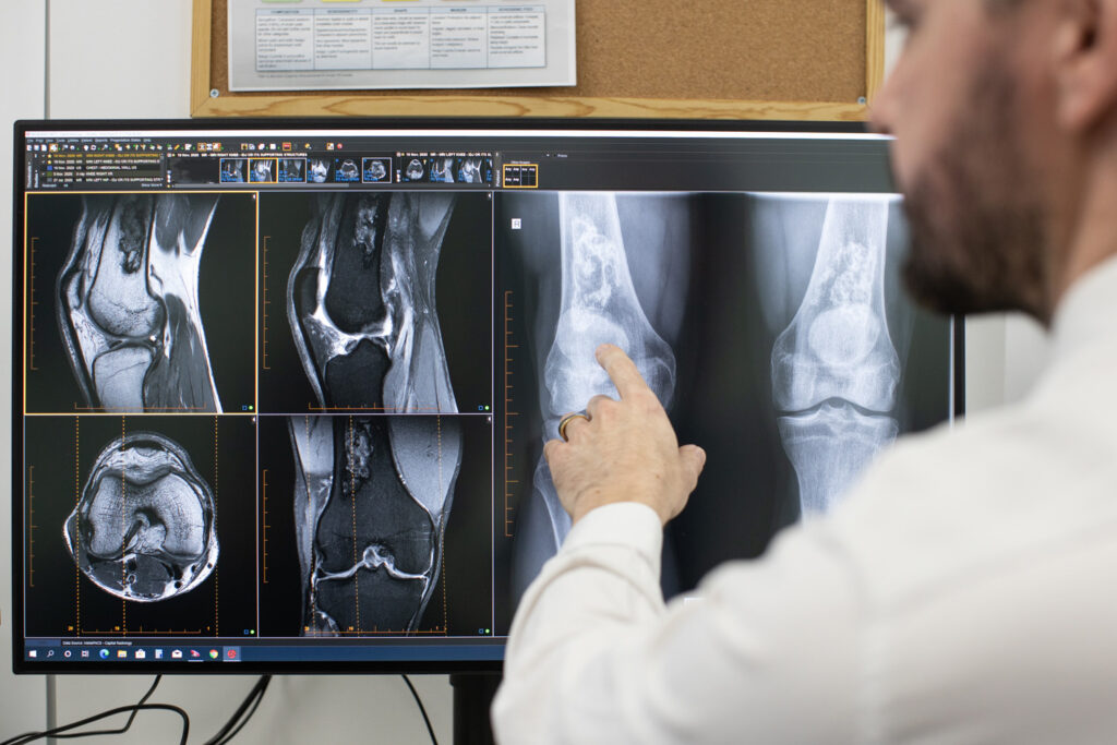 A radiologist at Radiology Tasmania pointing at computer screen with knee MRI scan displayed.